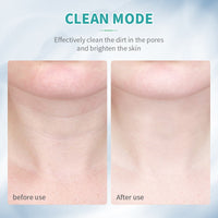 ANLAN double chin and wrinkle remover, skin tightening device for reducing fine lines and firming facial contours.