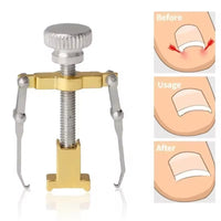 Stainless Steel Ingrown Toenail Corrector designed for precision treatment to relieve discomfort and promote proper nail growth.