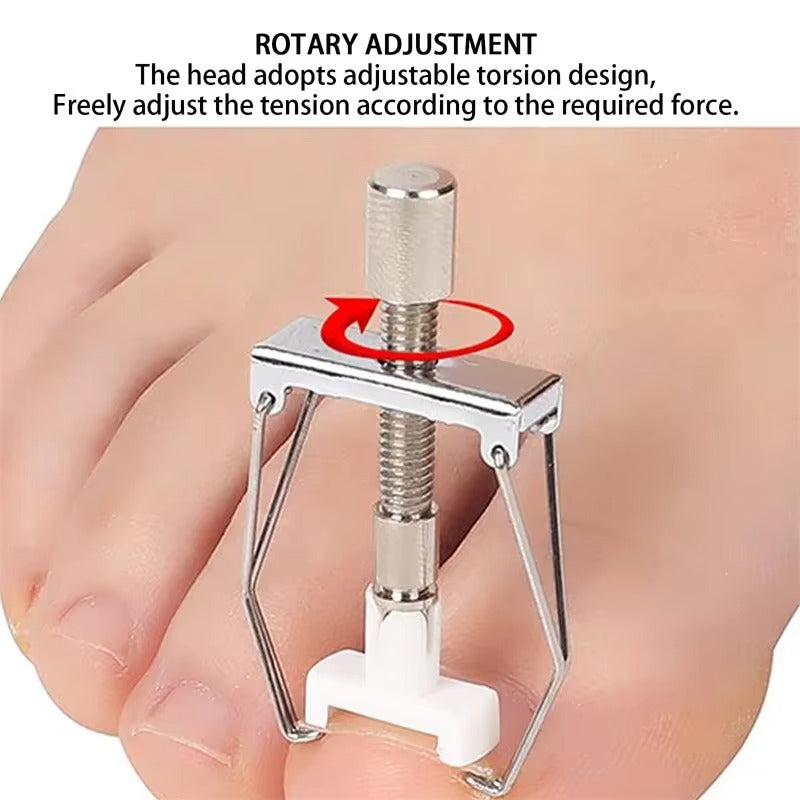 Stainless Steel Ingrown Toenail Corrector designed for precision treatment to relieve discomfort and promote proper nail growth.